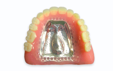 写真：自費 金属床義歯