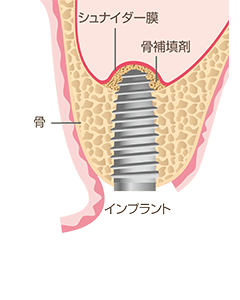 イラスト：3 