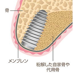 イラスト：1 